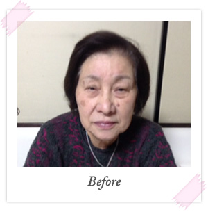 施術前